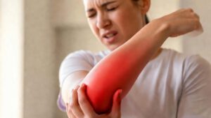 Frau hält schmerzenden Unterarm – Symptom einer Sehnenscheidenentzündung im Arm